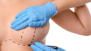 Breast Augmentation Atlantic County