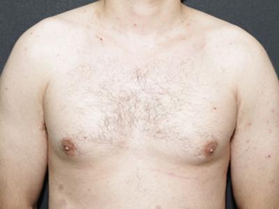 Main Photo Gallery, Case 6092, Before Treatment 