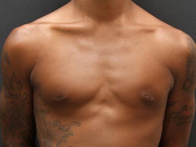 Main Photo Gallery, Case 6093, After Treatment