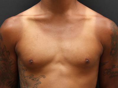Main Photo Gallery, Case 6093, Before Treatment 