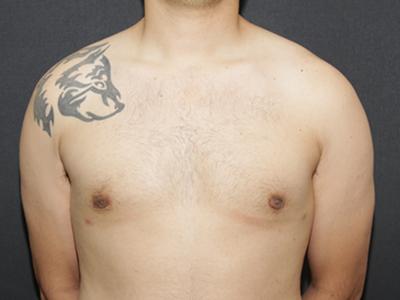 Main Photo Gallery, Case 6094, After Treatment