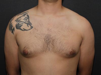 Main Photo Gallery, Case 6094, Before Treatment 