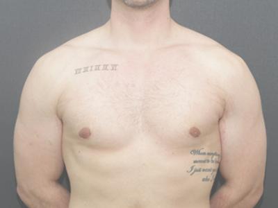Main Photo Gallery, Case 6095, After Treatment
