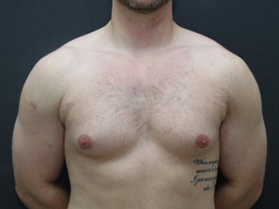 Main Photo Gallery, Case 6095, Before Treatment 