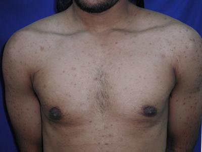Main Photo Gallery, Case 6096, After Treatment