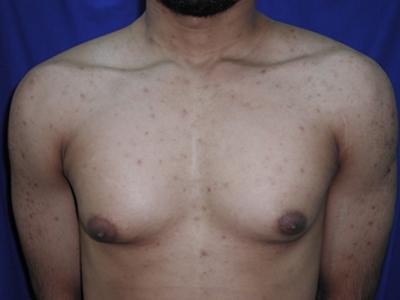 Main Photo Gallery, Case 6096, Before Treatment 