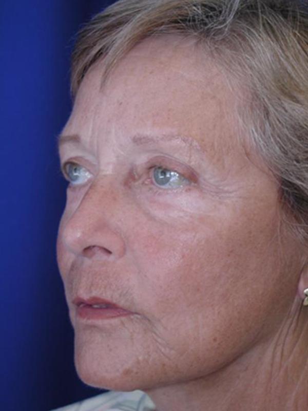 Main Photo Gallery, Case 6097, After Treatment