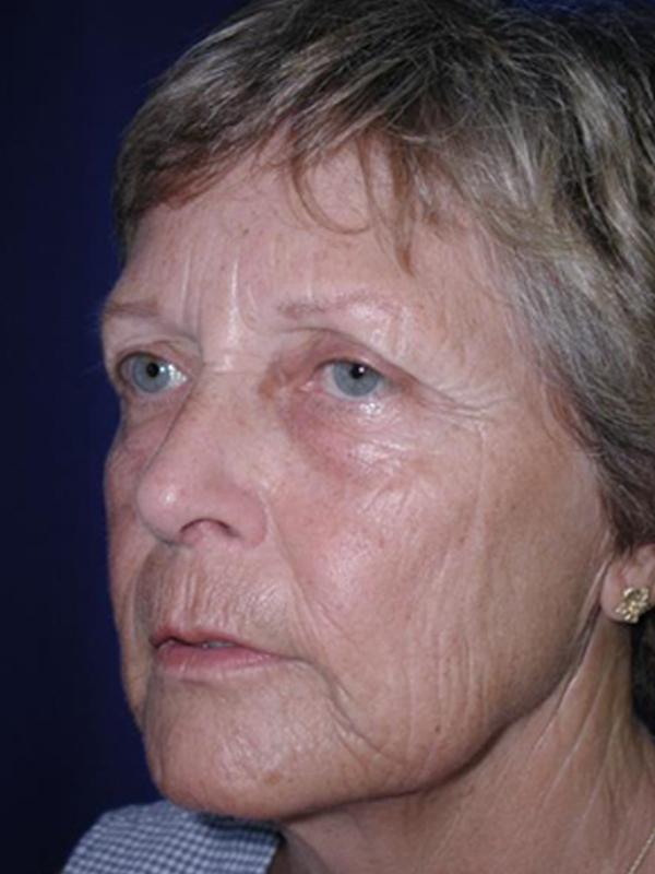Main Photo Gallery, Case 6097, Before Treatment 