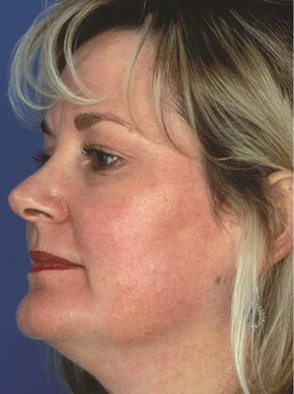 Main Photo Gallery, Case 6101, After Treatment