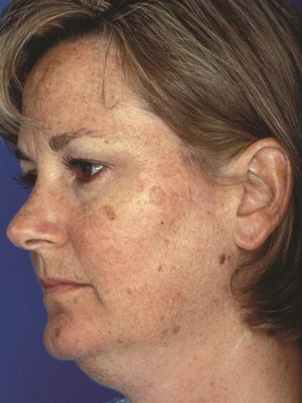 Main Photo Gallery, Case 6101, Before Treatment 