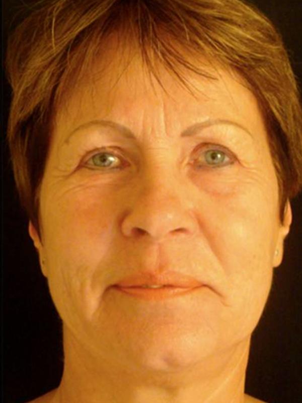 Main Photo Gallery, Case 6103, After Treatment