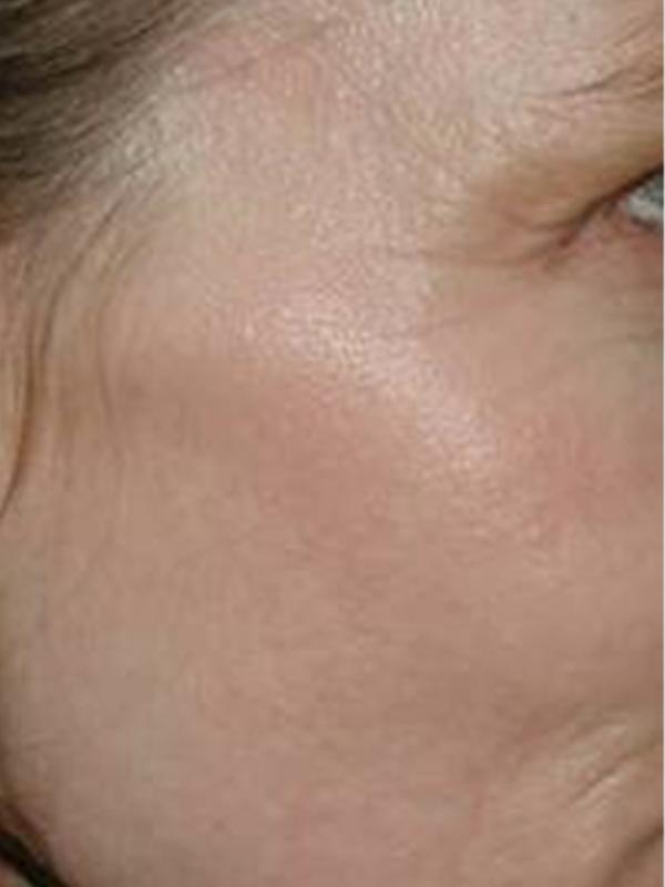 Main Photo Gallery, Case 6104, After Treatment