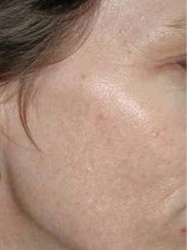 Main Photo Gallery, Case 6104, Before Treatment 