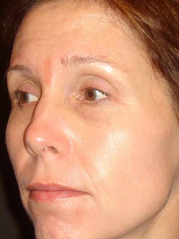 Main Photo Gallery, Case 6108, After Treatment