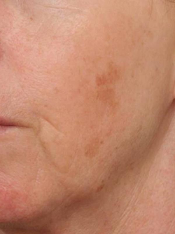 Main Photo Gallery, Case 6109, Before Treatment 