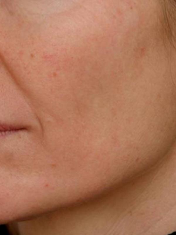 Main Photo Gallery, Case 6111, After Treatment