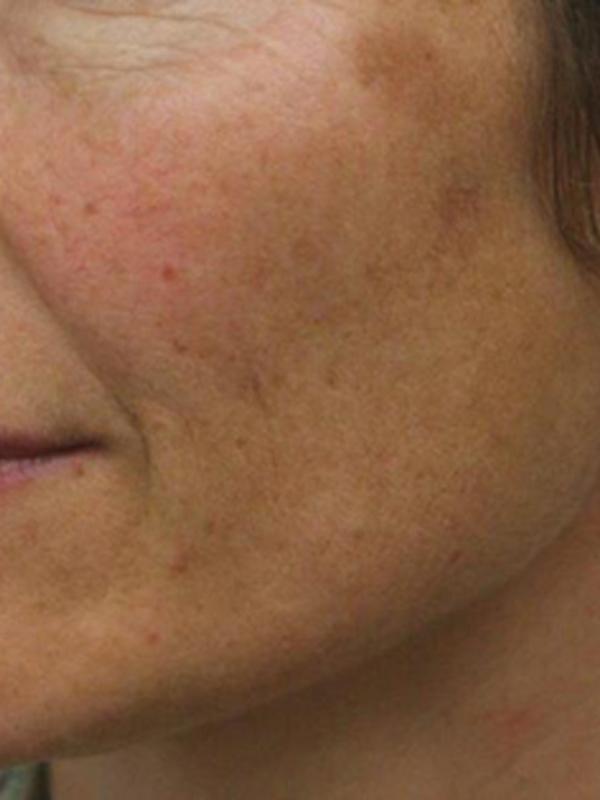 Main Photo Gallery, Case 6111, Before Treatment 