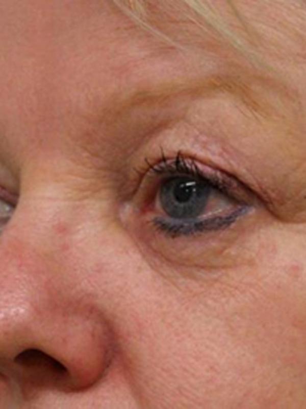 Main Photo Gallery, Case 6112, After Treatment