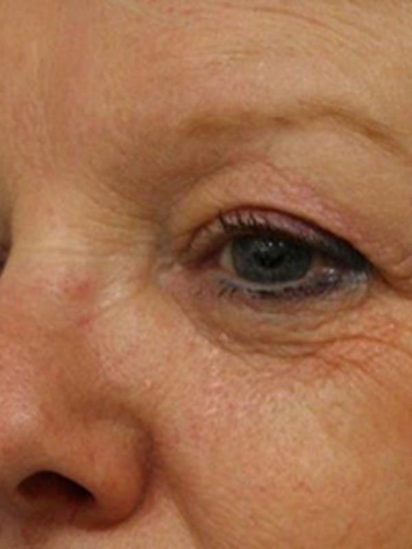 Main Photo Gallery, Case 6112, Before Treatment 