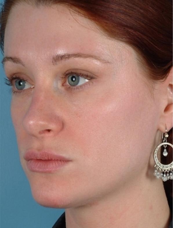 Main Photo Gallery, Case 6127, After Treatment