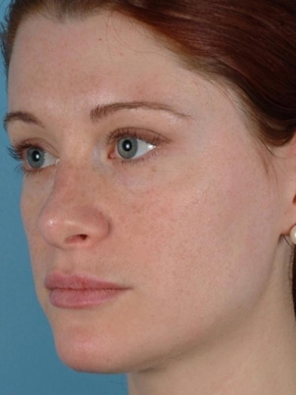 Main Photo Gallery, Case 6127, Before Treatment 
