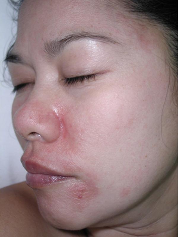 Main Photo Gallery, Case 6135, After Treatment