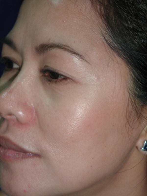 Main Photo Gallery, Case 6135, Before Treatment 