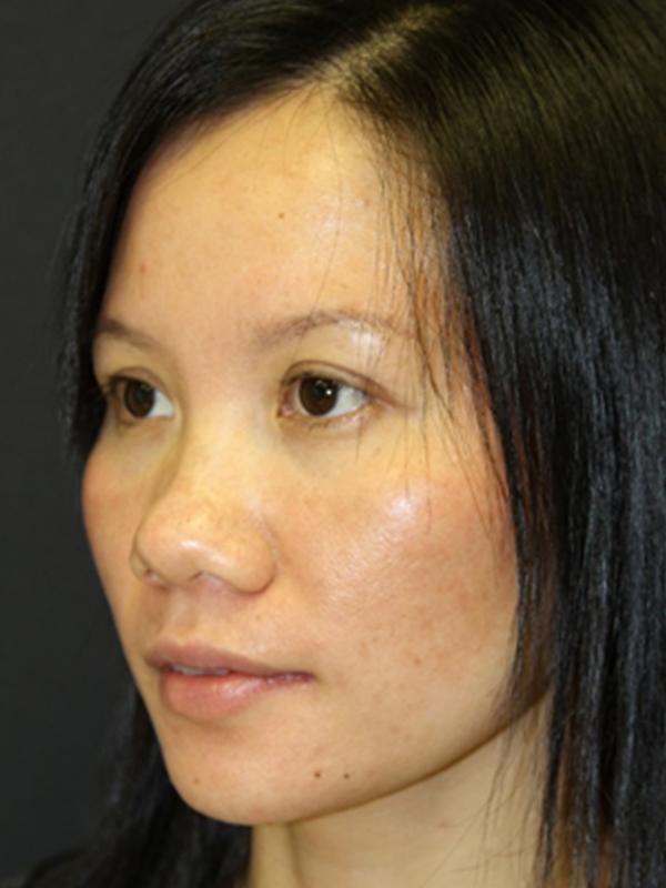 Main Photo Gallery, Case 6138, After Treatment