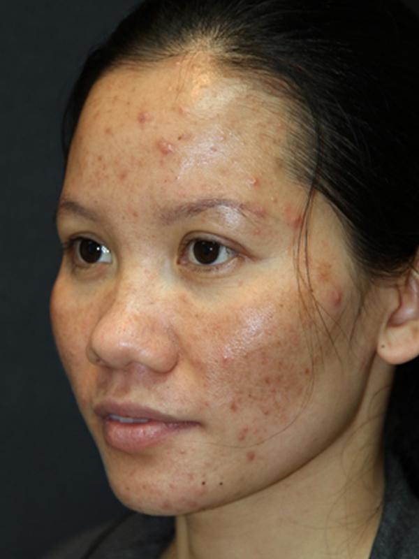 Main Photo Gallery, Case 6138, Before Treatment 