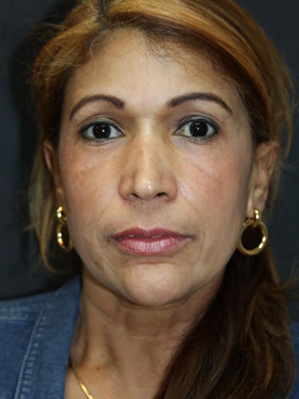 Main Photo Gallery, Case 6139, After Treatment