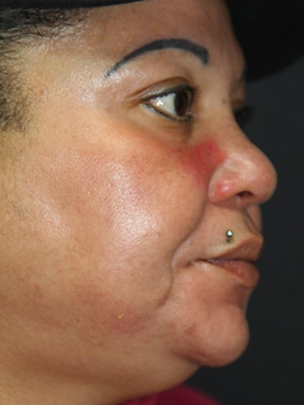 Main Photo Gallery, Case 6140, After Treatment