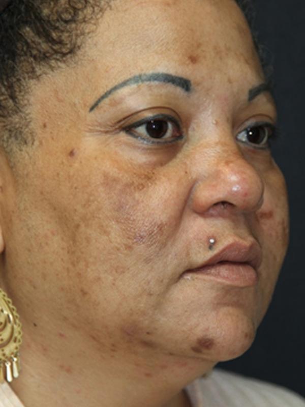 Main Photo Gallery, Case 6140, Before Treatment 