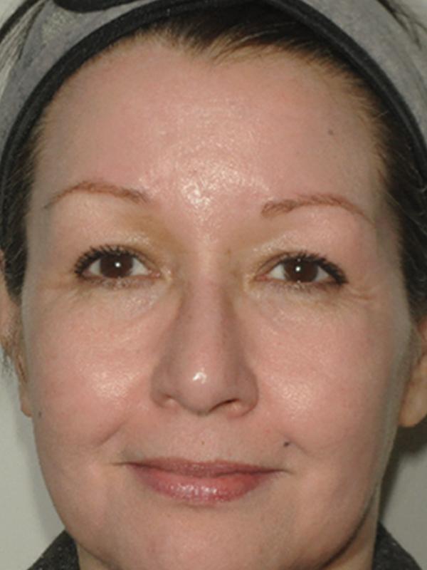 Main Photo Gallery, Case 6141, After Treatment