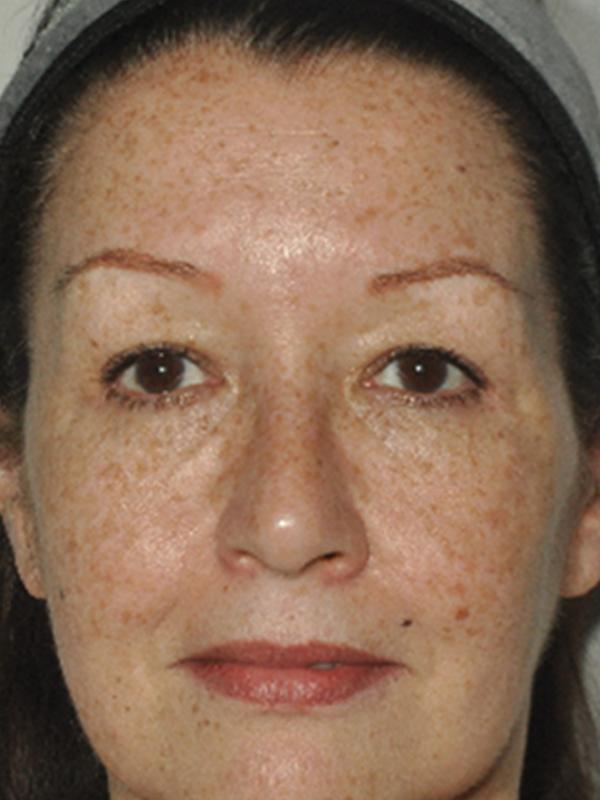 Main Photo Gallery, Case 6141, Before Treatment 