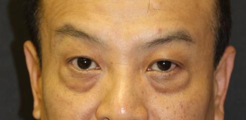 Main Photo Gallery, Case 6727, Before Treatment 