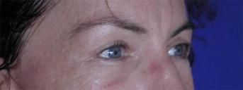 Main Photo Gallery, Case 6729, After Treatment