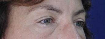 Main Photo Gallery, Case 6729, Before Treatment 
