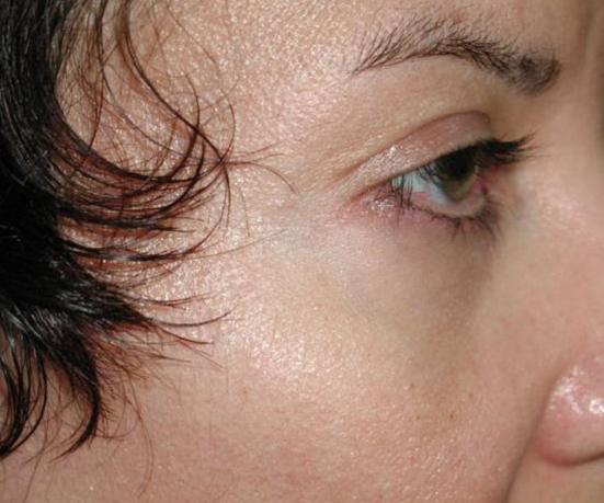 Main Photo Gallery, Case 6730, After Treatment