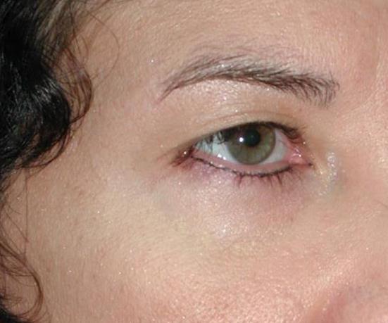 Main Photo Gallery, Case 6730, Before Treatment 