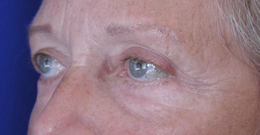 Main Photo Gallery, Case 6731, After Treatment