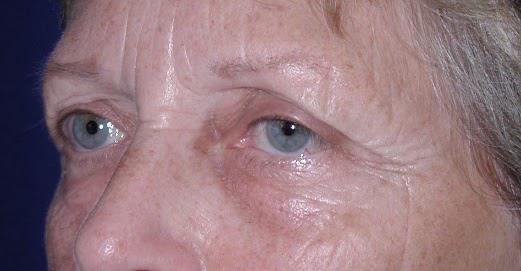 Main Photo Gallery, Case 6731, Before Treatment 