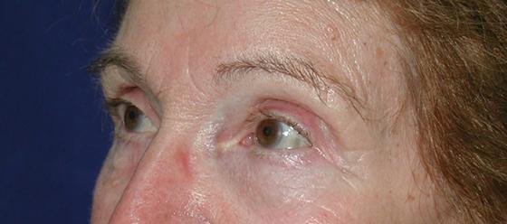 Main Photo Gallery, Case 6732, After Treatment