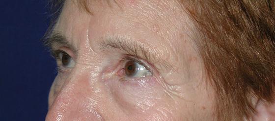 Main Photo Gallery, Case 6732, Before Treatment 