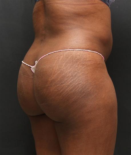Main Photo Gallery, Case 6745, Before Treatment 