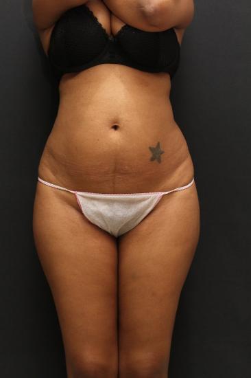 Main Photo Gallery, Case 6746, Before Treatment 