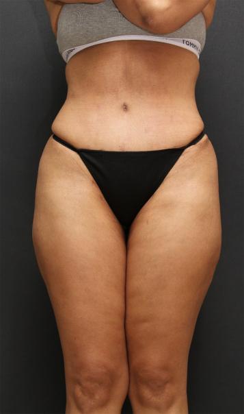 Main Photo Gallery, Case 6747, After Treatment