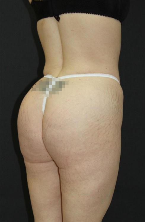 Main Photo Gallery, Case 6750, After Treatment