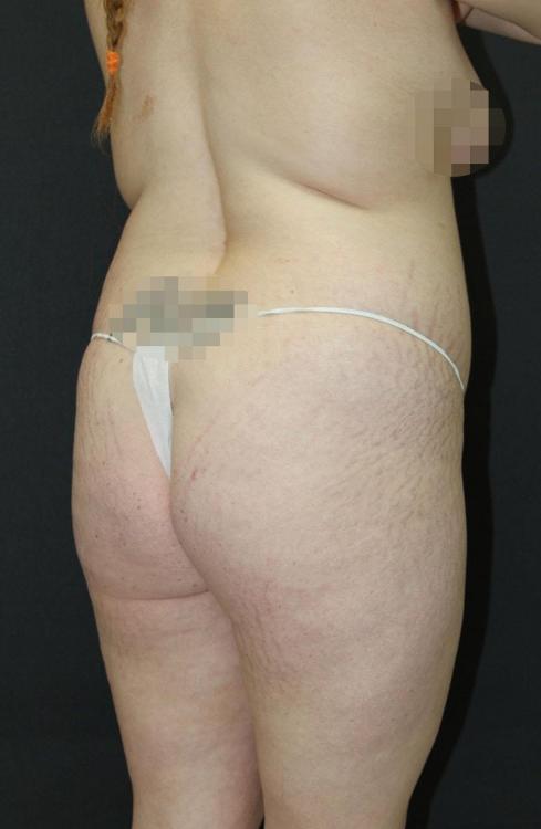 Main Photo Gallery, Case 6750, Before Treatment 