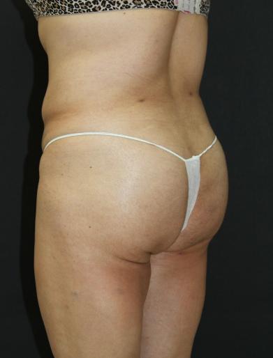 Main Photo Gallery, Case 6751, After Treatment