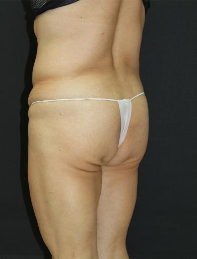 Main Photo Gallery, Case 6751, Before Treatment 